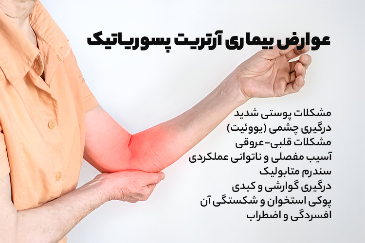 عوارض بیماری آرتریت پسوریاتیک
